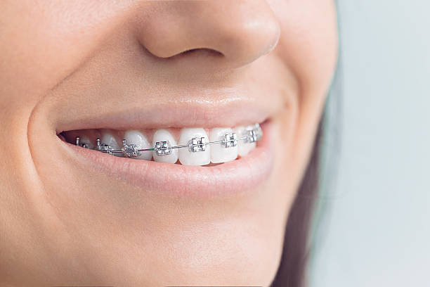 Best Tooth Extraction  in Burbank, CA